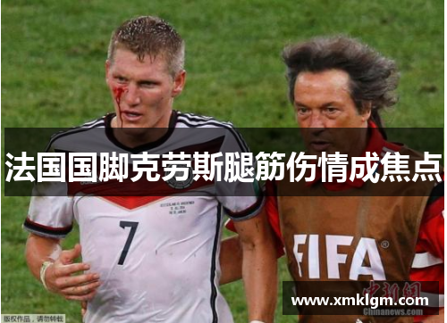 法国国脚克劳斯腿筋伤情成焦点